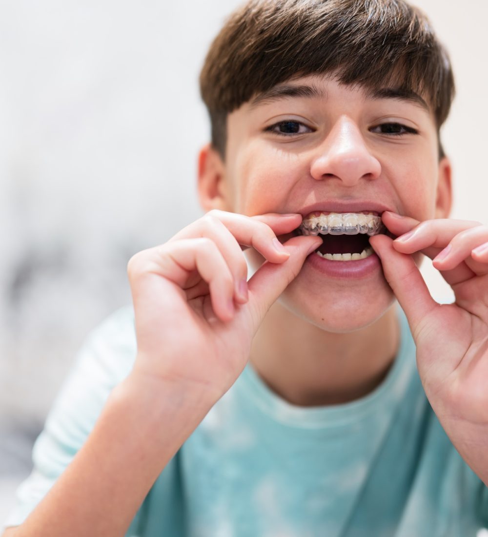 Dental concept, orthodontics.